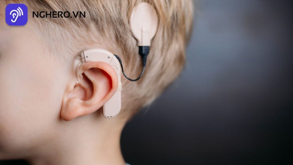 Ai nên cấy ốc tai điện tử